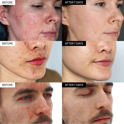 Final 3 Hours:70%OFF🔥Intensive Cica Repair Cream