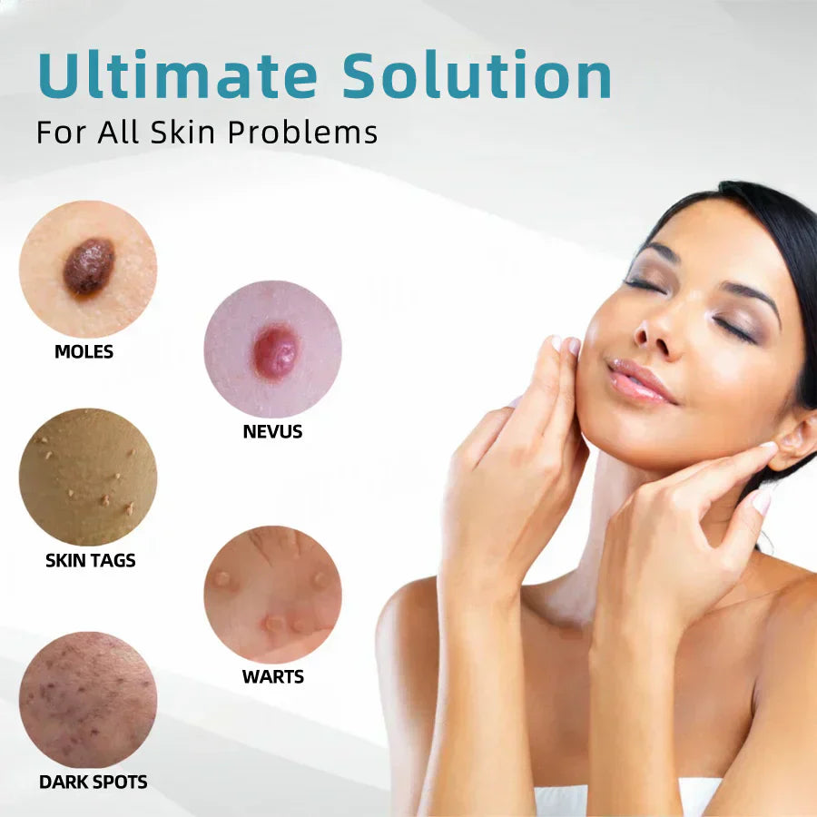 💕 All-in-One CO₂ Laser Eraser Pen | Removes Moles, Warts, Skin Flaws & Pigmentation✅