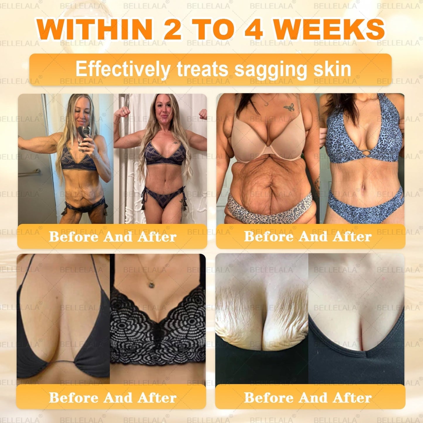 NEW & IMPROVED ✨Bellelala® 𝖡𝖾𝖾 𝗏𝖾𝗇𝗈𝗆 𝖲𝗄𝗂𝗇 𝖱𝖾𝗌𝗍𝗈𝗋𝖺𝗍𝗂𝗈𝗇 𝖢𝗋𝖾𝖺𝗆