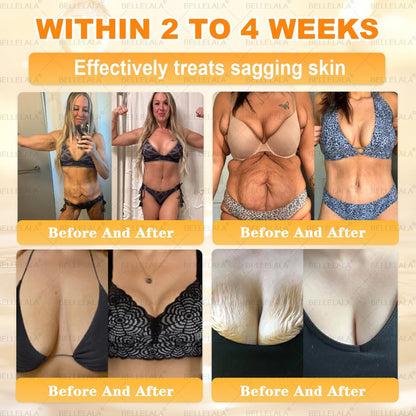 NEW & IMPROVED ✨Bellelala® 𝖡𝖾𝖾 𝗏𝖾𝗇𝗈𝗆 𝖲𝗄𝗂𝗇 𝖱𝖾𝗌𝗍𝗈𝗋𝖺𝗍𝗂𝗈𝗇 𝖢𝗋𝖾𝖺𝗆