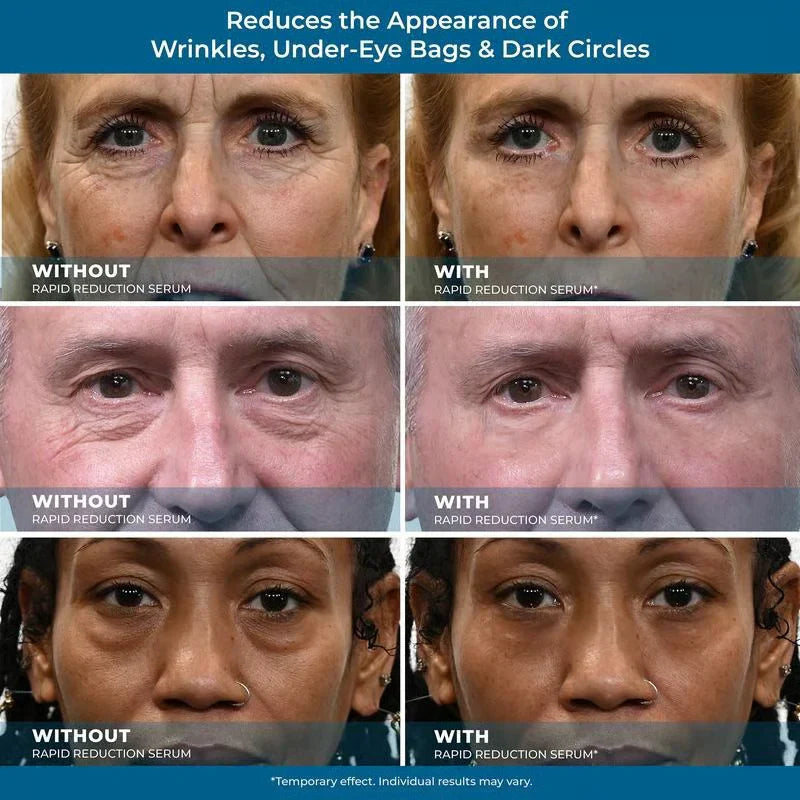 Rapid Reduction Eye Serum – Instant Tightening & Anti-Aging for Eyes & Face ✨