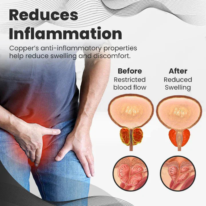 【🏆🏆Official Brand Store】Ringmiz Copper Mag Prostate Therapy Ring（Limited Time Discount 🔥 Last Day）