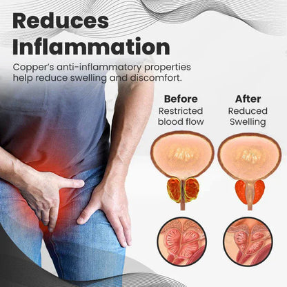 【🏆🏆Official Brand Store】Ringmiz Copper Mag Prostate Therapy Ring（Limited Time Discount 🔥 Last Day）