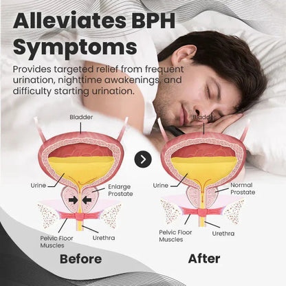 【🏆🏆Official Brand Store】Ringmiz Copper Mag Prostate Therapy Ring（Limited Time Discount 🔥 Last Day）