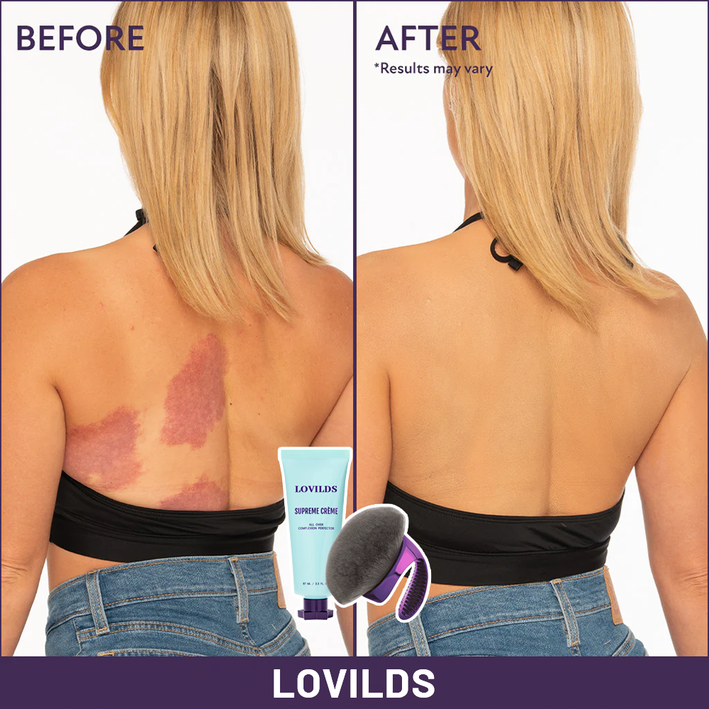 Final 3 Hours: 60% OFF🔥 All Over Complexion Perfector